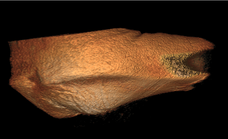 3D rendering of a buttocks with heavily contoured peaks at the ischium.